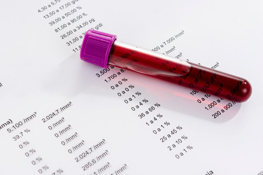 Co mówi o Twoim zdrowiu morfologia krwi? | ArtMedica